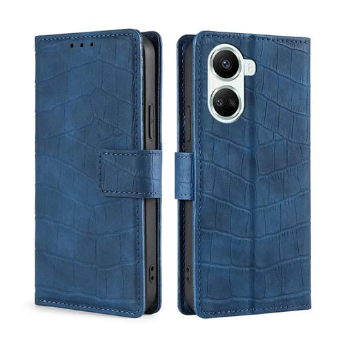 Funda de Cuero para Huawei Nova 10 Se Skin Feel Cocodrilo con Cierre Magnético (Azul)