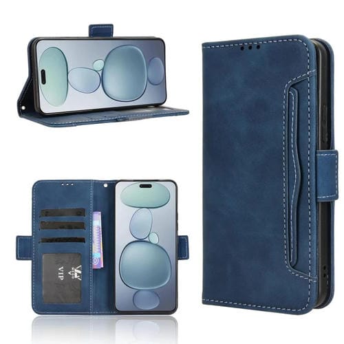 Funda de piel con textura de becerro y ranuras para tarjetas para Xiaomi Civi 5 Pro 5G (azul)